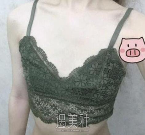 张立彬,丰胸