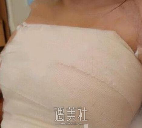 张立彬,丰胸