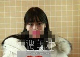 大连,秦宏智,双眼皮