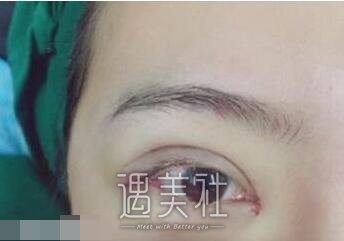 大连,秦宏智,双眼皮