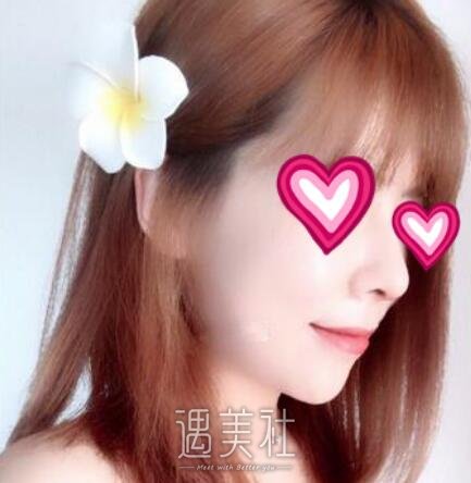 北京,八大处,杨欣,隆鼻