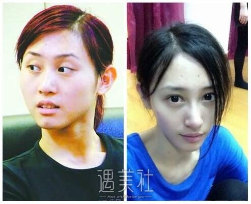 朱洁静整容前后对比差异还是有点大呢?一起来瞧瞧~