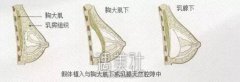 昆明奥诺拉假体丰胸价格高不高，收费区间? width=