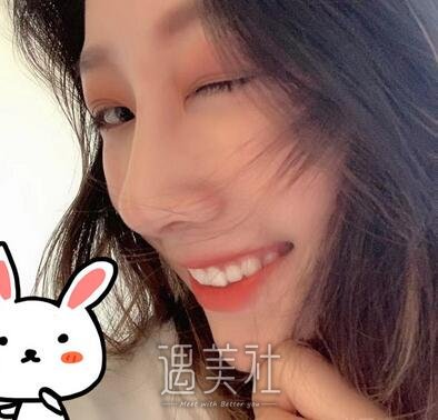 周柯,隆鼻