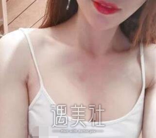 罗盛康,丰胸
