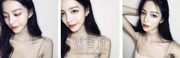 张恒术,双眼皮