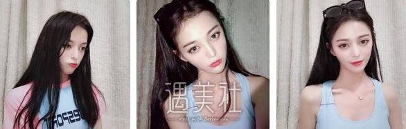 张恒术,双眼皮