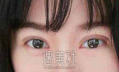 李东,双眼皮