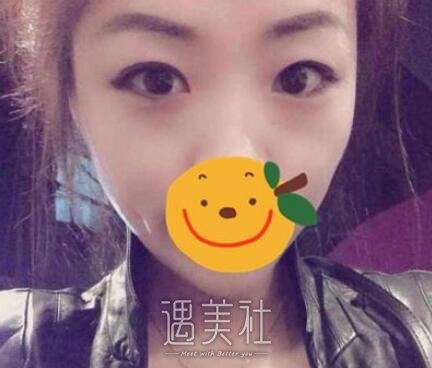 杨杰,双眼皮