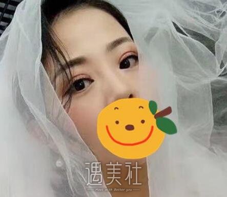 杨杰,双眼皮
