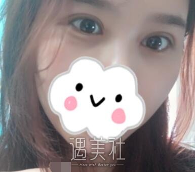 杨亚益,双眼皮