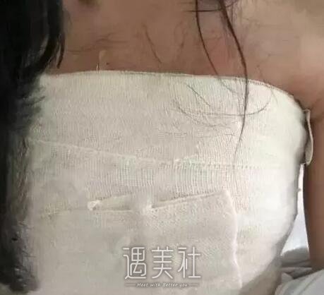石蕾,丰胸