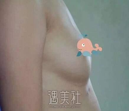 北京,王明利,丰胸