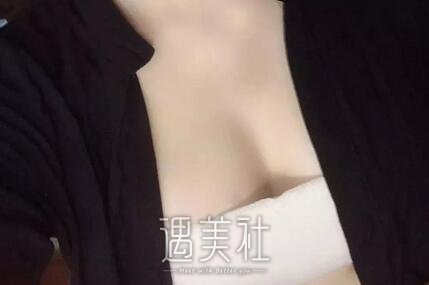 北京,王明利,丰胸