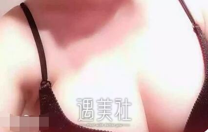 北京,王明利,丰胸
