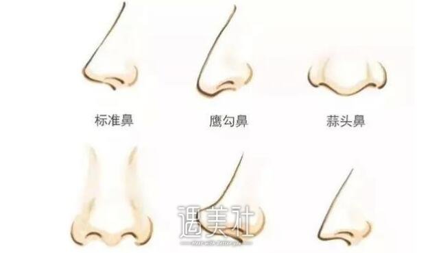 深圳垫鼻子需要多少钱，什么样的价格合理?