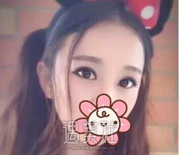 周口缔莱美整形医院双眼皮技术如何?有相关案例分享吗?