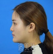 戴传昌做鼻子风格是什么样子的：看看我的真实案例吧~ width=