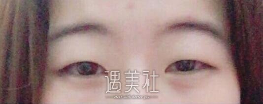 西京,肖博