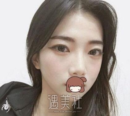 王振军,双眼皮