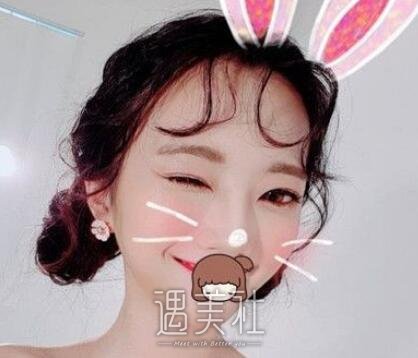 王振军,双眼皮