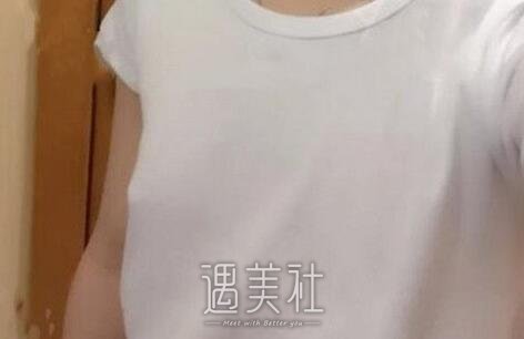 李高峰,丰胸