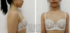 刘成胜丰胸真实案例 亲身实力验证神话是否属实 width=