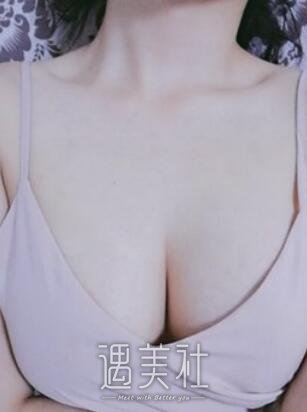 刘成胜,丰胸