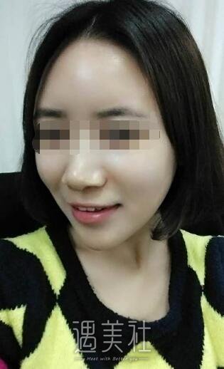 南宁美丽焦点整形医院正规吗?做面部脂肪填充果如何?