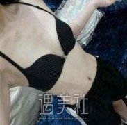 罗盛康丰胸案例图片：从A到C的改变就这么简单！ width=