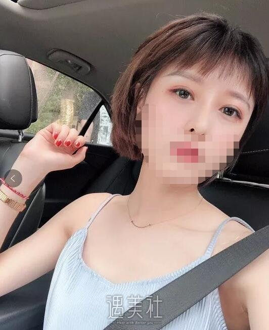永康美莱整形医院做隆鼻项目果如何?我想摆脱现状~