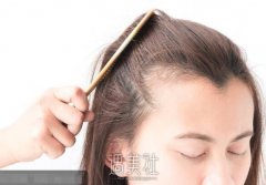 毛发移植果怎么样|毛发移植果优缺点大盘点~ width=