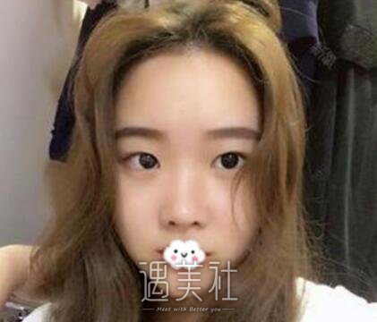 吴振,双眼皮