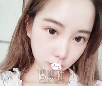 吴振,双眼皮