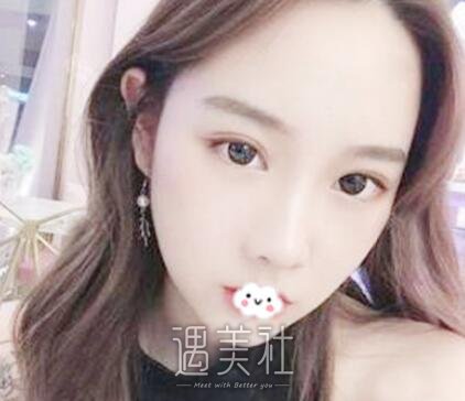 吴振,双眼皮