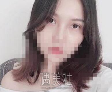 靳小雷,双眼皮