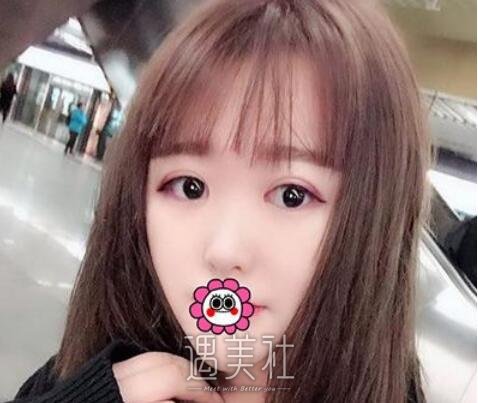 薛志强,双眼皮