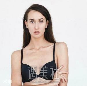 程晓林,丰胸
