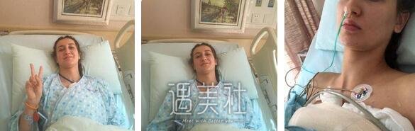 程晓林,丰胸