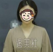 李德廷整形丰胸案例：男闺蜜再也不叫我兄弟了！ width=