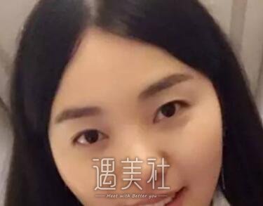 济南,海峡,吴银堂,双眼皮