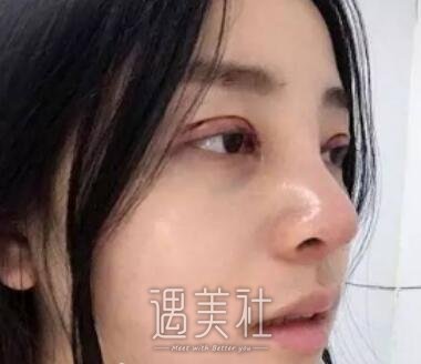 济南,海峡,吴银堂,双眼皮