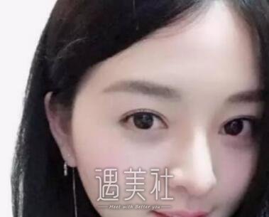 济南,海峡,吴银堂,双眼皮