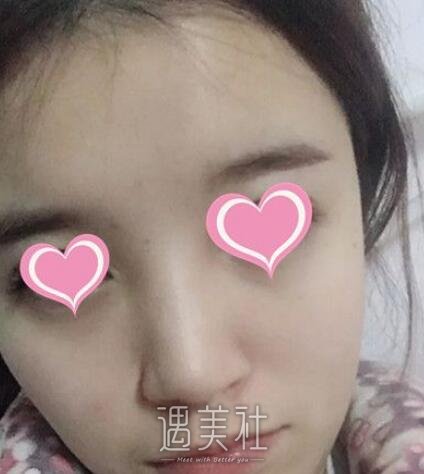 朴光哲