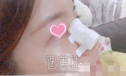 朴光哲