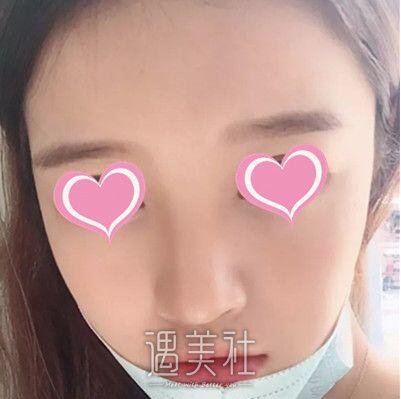 朴光哲