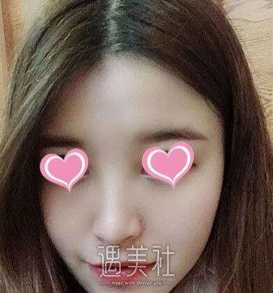 朴光哲