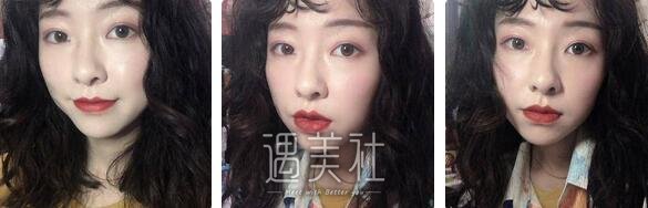 薛峰,双眼皮