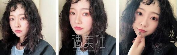 薛峰,双眼皮