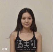 董岩岩丰胸案例 手感还不错 width=